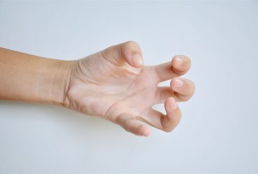 Dystonia