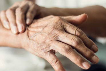 Movement Disorders