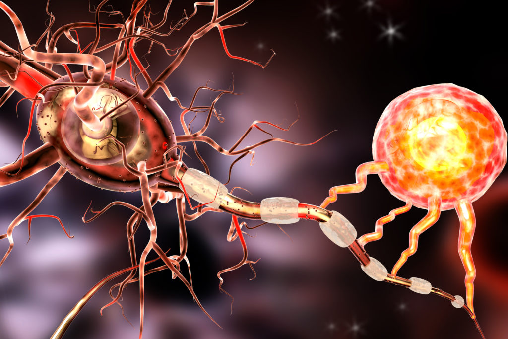 What are the symptoms of multiple sclerosis? Is there any treatment?