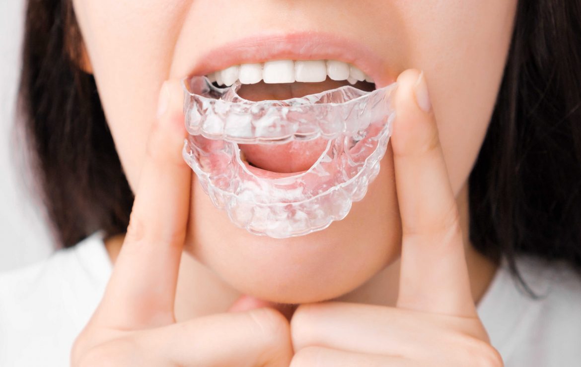 Diş Sıkma (Bruksizm) Baş Ağrısı Yapar mı ve Bu Hastalığın Tedavisinde Botox Nasıl Uygulanır?